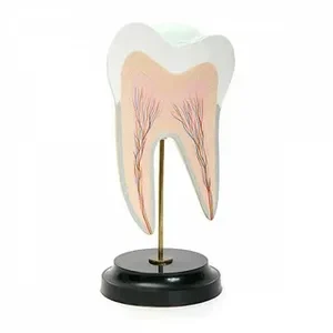 DENTAL CARIES MODEL
